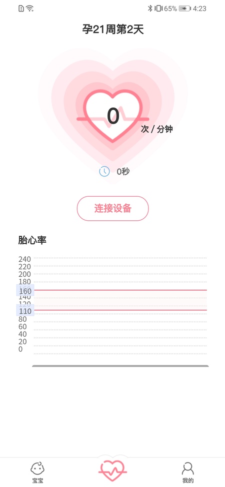 fetalheart胎心仪