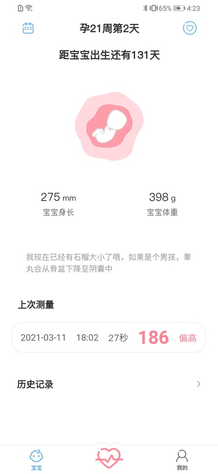 fetalheart胎心仪