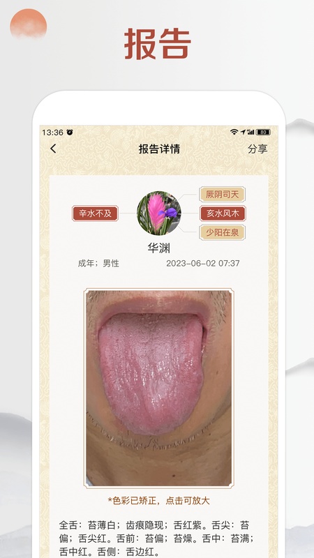 看舌头
